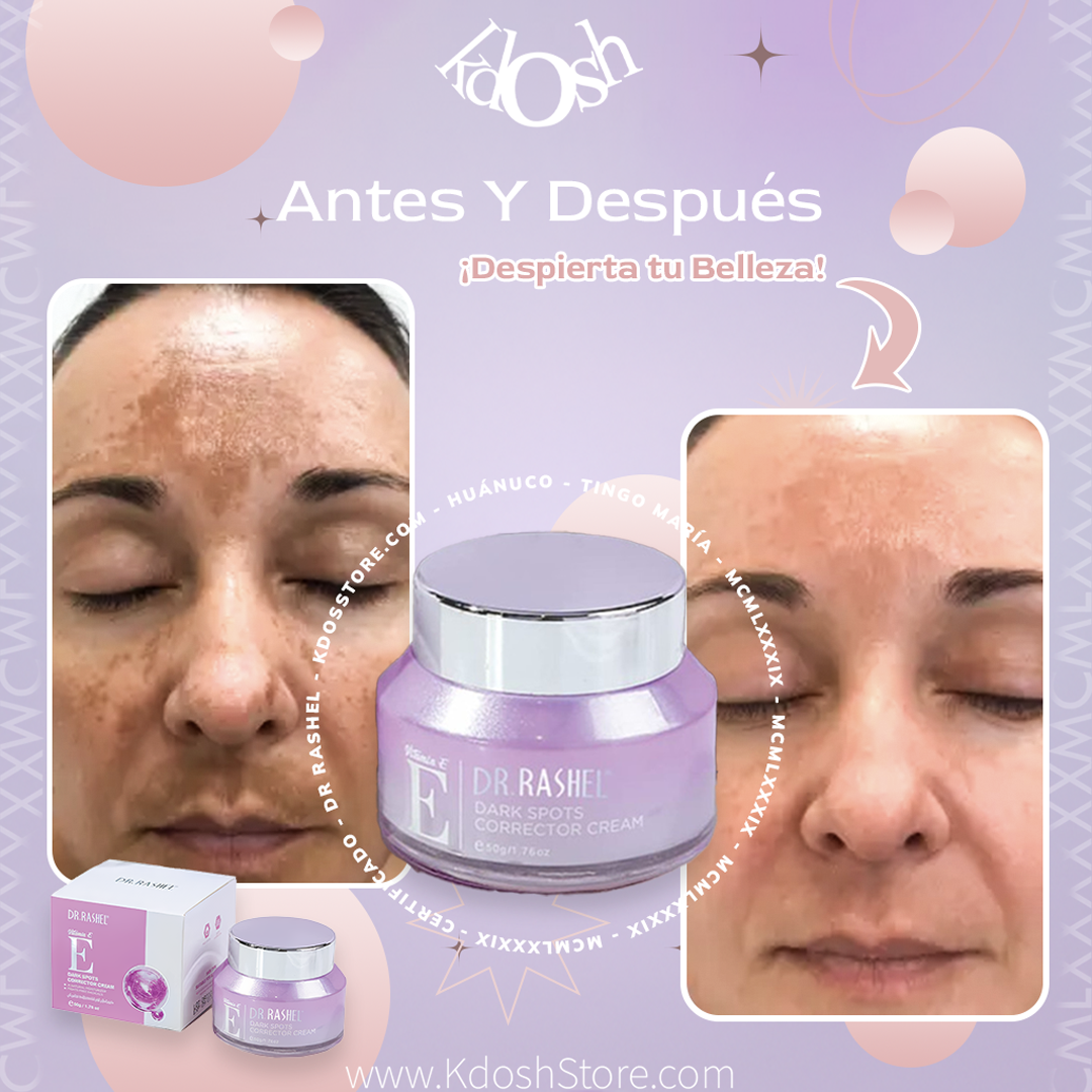 Crema Facial Dr. Rashel Vitamina E – Hidratación y Elasticidad al Instante